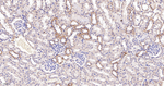 N-WASP Recombinant Rabbit Monoclonal Antibody (11C5)