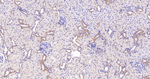 N-WASP Antibody in Immunohistochemistry (Paraffin) (IHC (P))