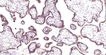 ERAB Antibody in Immunohistochemistry (Paraffin) (IHC (P))
