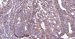ERAB Recombinant Rabbit Monoclonal Antibody (4H15)