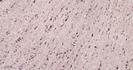 ERAB Antibody in Immunohistochemistry (Paraffin) (IHC (P))
