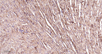ERAB Antibody in Immunohistochemistry (Paraffin) (IHC (P))