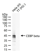 C/EBP beta Antibody in Western Blot (WB)