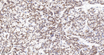 PDCD4 Recombinant Rabbit Monoclonal Antibody (17B8)