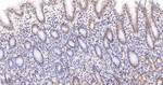 PDCD4 Antibody in Immunohistochemistry (Paraffin) (IHC (P))