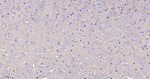 SPTAN1 Antibody in Immunohistochemistry (Paraffin) (IHC (P))