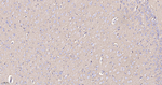 SPTAN1 Antibody in Immunohistochemistry (Paraffin) (IHC (P))