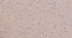 SPTAN1 Antibody in Immunohistochemistry (Paraffin) (IHC (P))