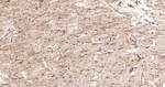 SPTAN1 Antibody in Immunohistochemistry (Paraffin) (IHC (P))