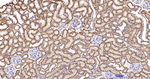 SPTAN1 Antibody in Immunohistochemistry (Paraffin) (IHC (P))