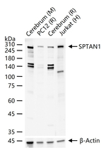 SPTAN1 Antibody in Western Blot (WB)
