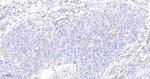 BAG3 Antibody in Immunohistochemistry (Paraffin) (IHC (P))
