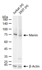 Menin Recombinant Rabbit Monoclonal Antibody (10D9)