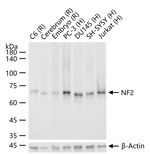NF2 Antibody in Western Blot (WB)