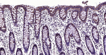 CEACAM6 Antibody in Immunohistochemistry (Paraffin) (IHC (P))