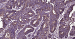 CEACAM6 Antibody in Immunohistochemistry (Paraffin) (IHC (P))