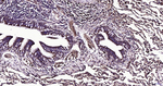 CEACAM6 Antibody in Immunohistochemistry (Paraffin) (IHC (P))
