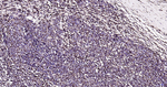 CEACAM6 Recombinant Rabbit Monoclonal Antibody (4E2)