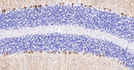 IP3 Receptor 1 Recombinant Rabbit Monoclonal Antibody (13E1)