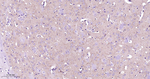 IP3 Receptor 1 Antibody in Immunohistochemistry (Paraffin) (IHC (P))