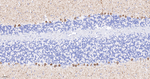 IP3 Receptor 1 Antibody in Immunohistochemistry (Paraffin) (IHC (P))