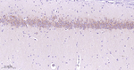 IP3 Receptor 1 Antibody in Immunohistochemistry (Paraffin) (IHC (P))