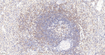 IP3 Receptor 1 Antibody in Immunohistochemistry (Paraffin) (IHC (P))