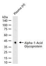 ORM1 Antibody in Western Blot (WB)