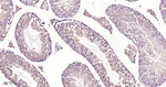 TrxR1 Antibody in Immunohistochemistry (Paraffin) (IHC (P))