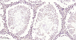 TrxR1 Antibody in Immunohistochemistry (Paraffin) (IHC (P))