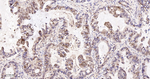 TrxR1 Antibody in Immunohistochemistry (Paraffin) (IHC (P))