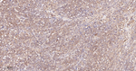TrxR1 Antibody in Immunohistochemistry (Paraffin) (IHC (P))