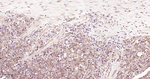 TrxR1 Antibody in Immunohistochemistry (Paraffin) (IHC (P))