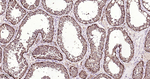 TrxR1 Antibody in Immunohistochemistry (Paraffin) (IHC (P))