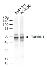 TrxR1 Antibody in Western Blot (WB)