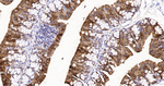 Carbonic Anhydrase II Antibody in Immunohistochemistry (Paraffin) (IHC (P))