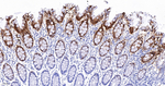 Carbonic Anhydrase II Recombinant Rabbit Monoclonal Antibody (10E4)