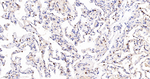 Carbonic Anhydrase II Antibody in Immunohistochemistry (Paraffin) (IHC (P))