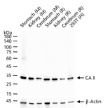 Carbonic Anhydrase II Antibody in Western Blot (WB)