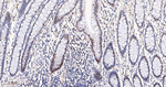 CHK2 Antibody in Immunohistochemistry (Paraffin) (IHC (P))