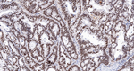 CHK2 Recombinant Rabbit Monoclonal Antibody (7D13)