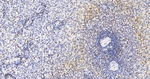 CHK2 Antibody in Immunohistochemistry (Paraffin) (IHC (P))