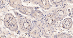 CHK2 Antibody in Immunohistochemistry (Paraffin) (IHC (P))