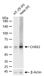 CHK2 Antibody in Western Blot (WB)