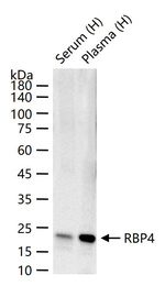 RBP4 Antibody in Western Blot (WB)