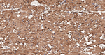 FABP3 Antibody in Immunohistochemistry (Paraffin) (IHC (P))