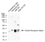 Folate Receptor alpha Recombinant Rabbit Monoclonal Antibody (4E2)