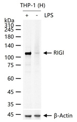 RIG-I Recombinant Rabbit Monoclonal Antibody (4D10)