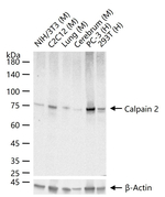 Calpain 2 Recombinant Rabbit Monoclonal Antibody (8F5)