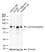 DDR2 Recombinant Rabbit Monoclonal Antibody (12G6)